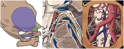 Surgical corridors to foramen magnum meningiomas: a mini-review